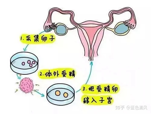 北京石景山区第三代试管婴儿成功率有多少？