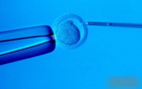 北海市三代试管婴儿能选性别吗？一次多少费用呢？