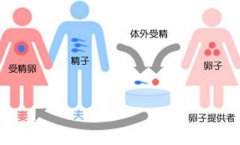在广州市做三代供卵试管需要多少钱？