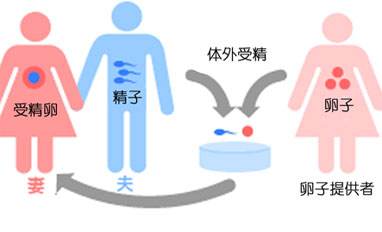 临夏回族自治州供卵试管周期收费?龙凤胎要不要加钱?