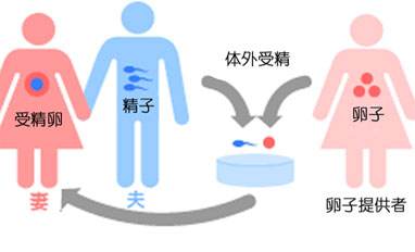 青岛借卵试管机构借卵步骤跟注意事项